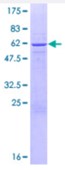 SDS-PAGE (DHRS9-2603H).jpg